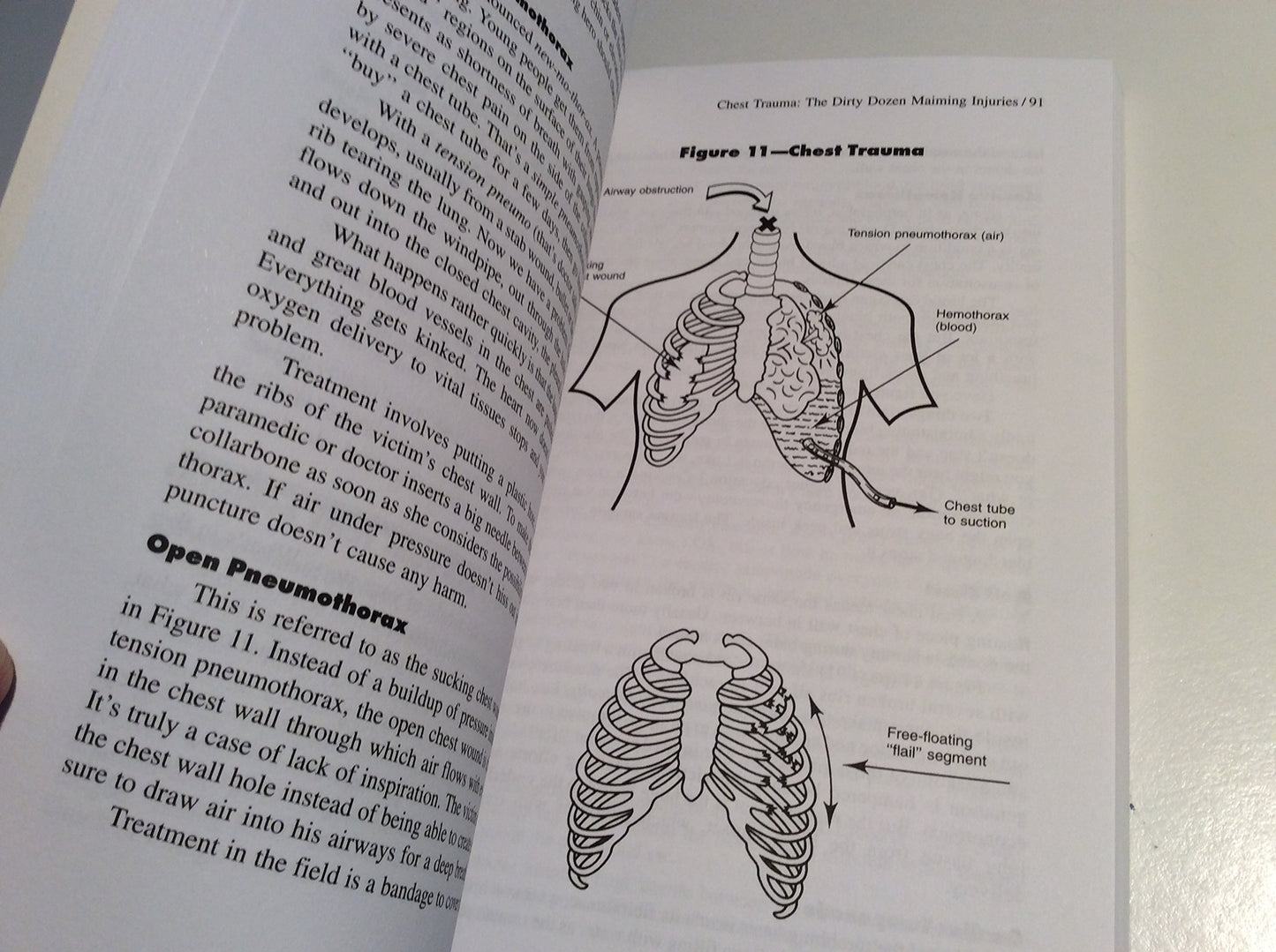 Body Trauma: A Writer's Guide to Wounds and Injuries (Howdunit Series)
