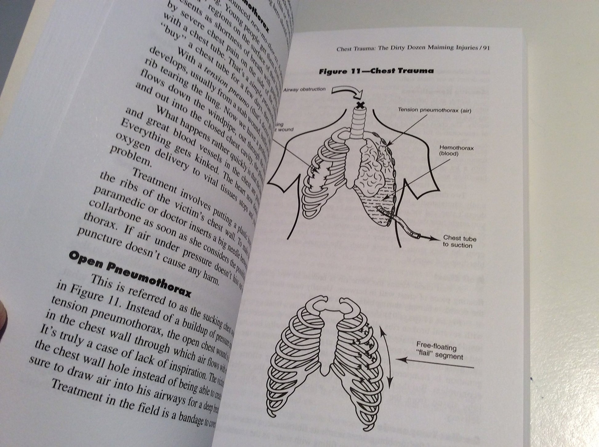 Body Trauma: A Writer's Guide to Wounds and Injuries (Howdunit Series)