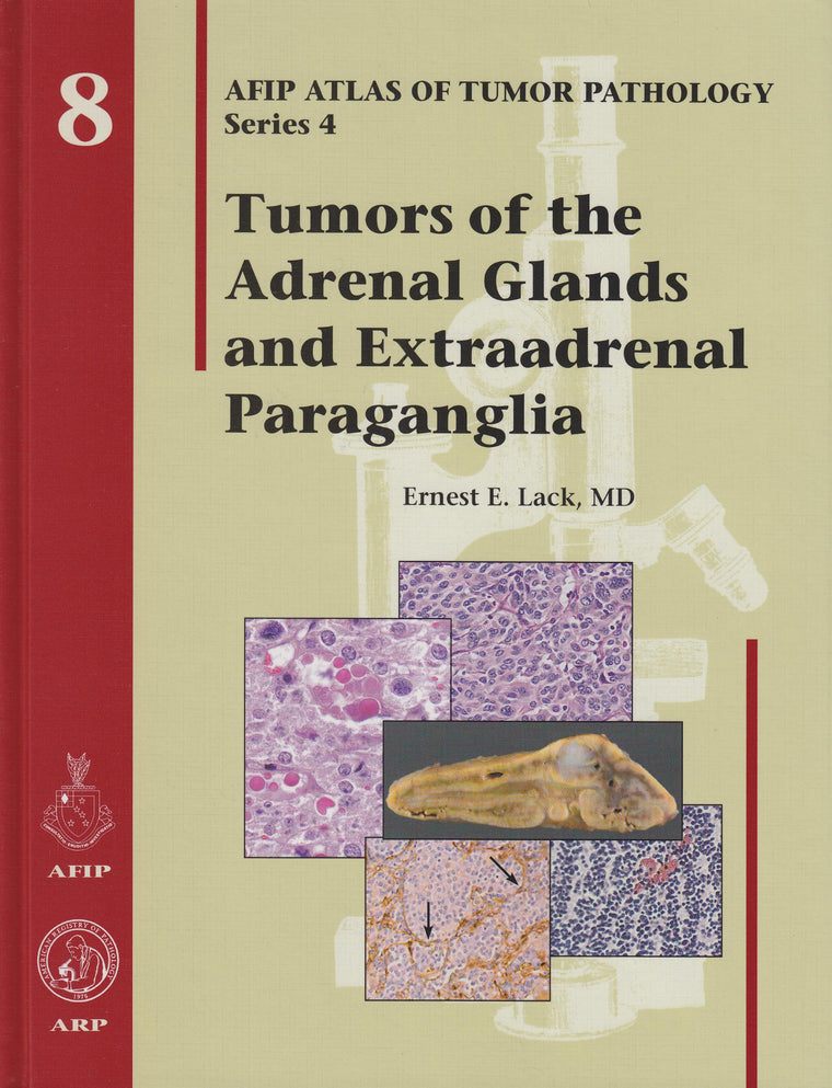 Tumors of the Adrenal Glands and Extraadrenal Paraganglia - Volume 8 (Afip Atlas of Tumor Pathology Series 4)