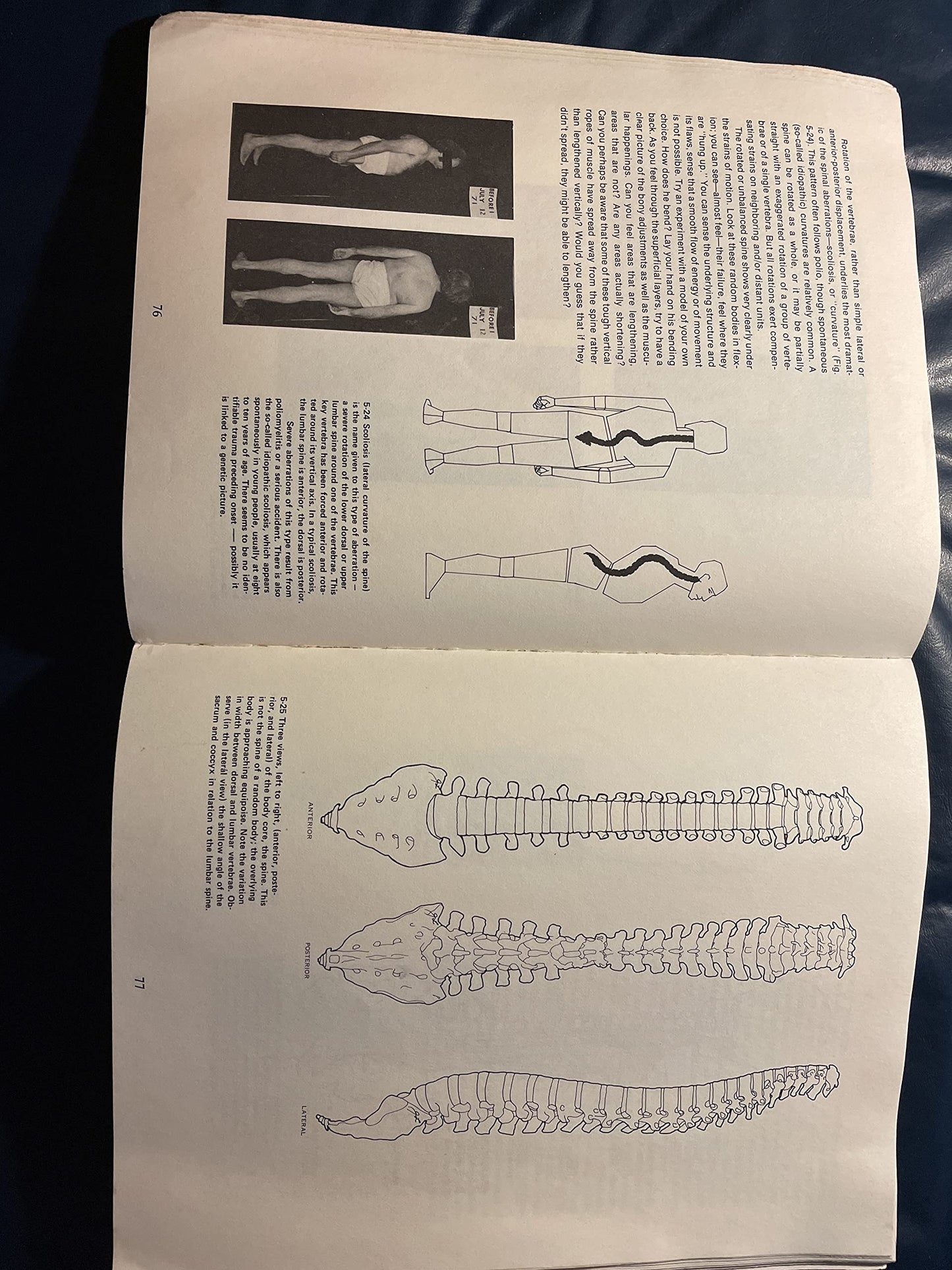 Rolfing: The Integration of Human Structures