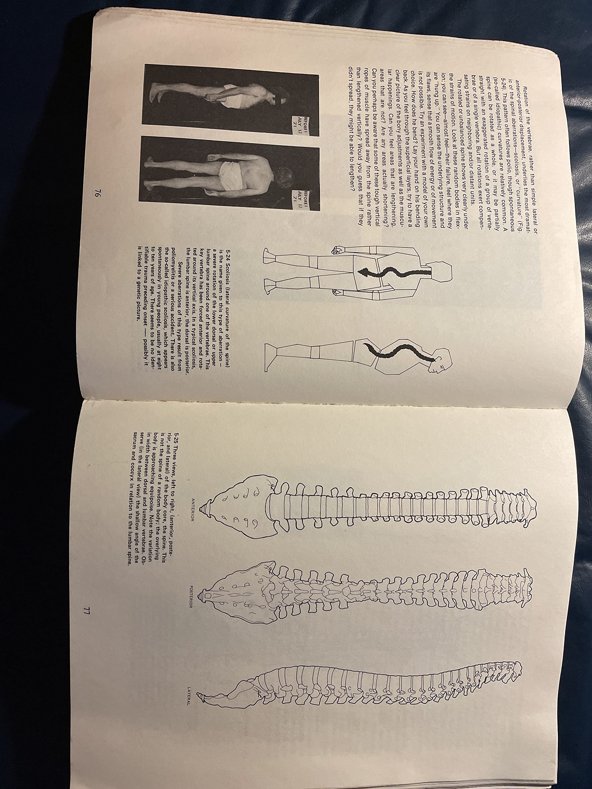 Rolfing: The Integration of Human Structures