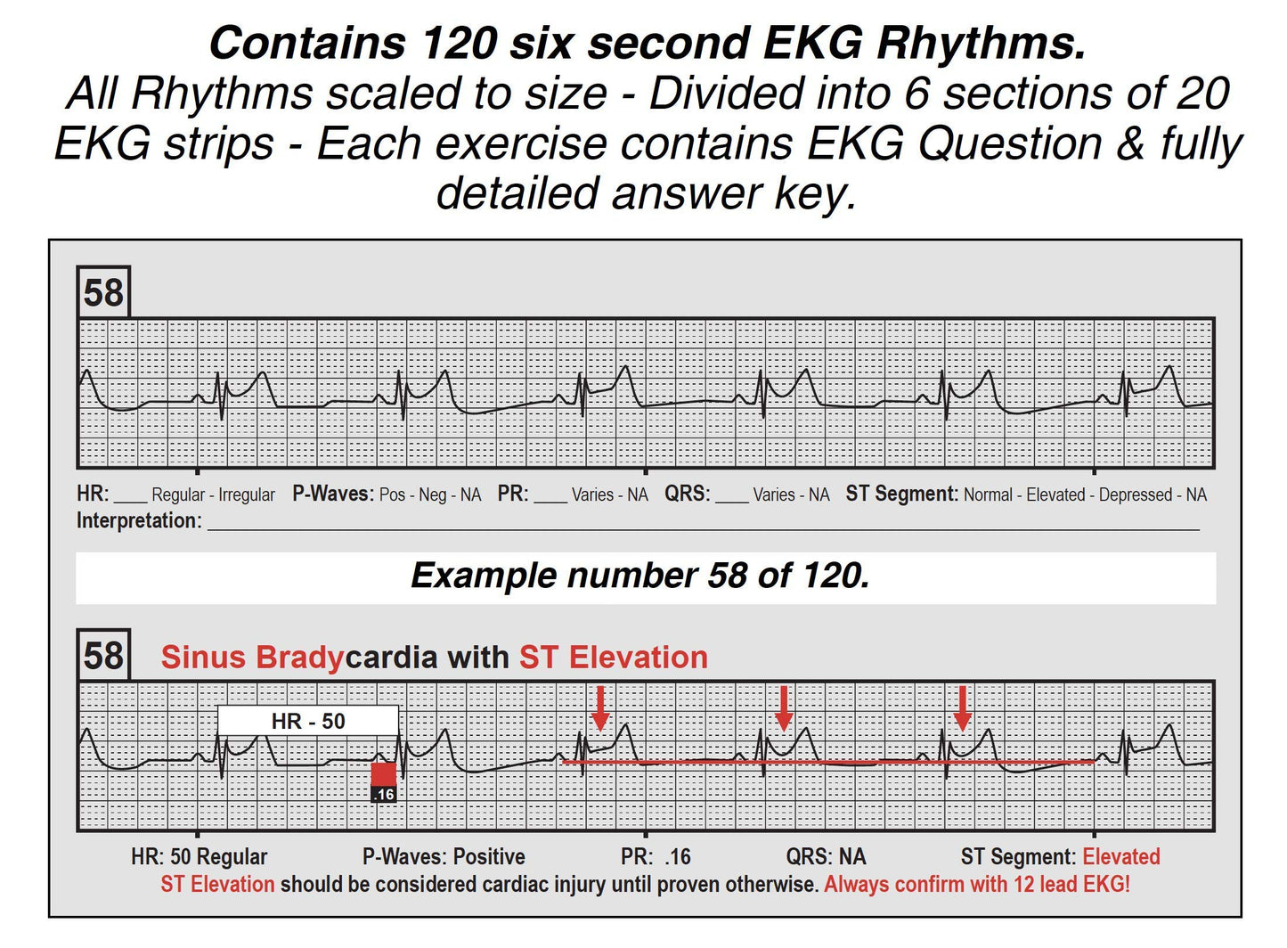 R-CAT EKG Workbook Series 1 - Includes R-CAT EKG Badge