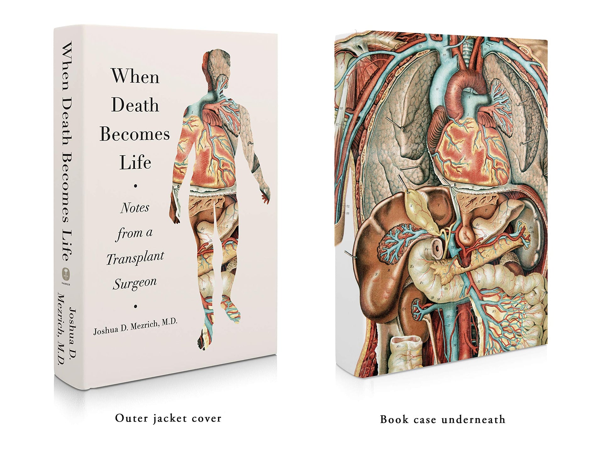 When Death Becomes Life: Notes from a Transplant Surgeon