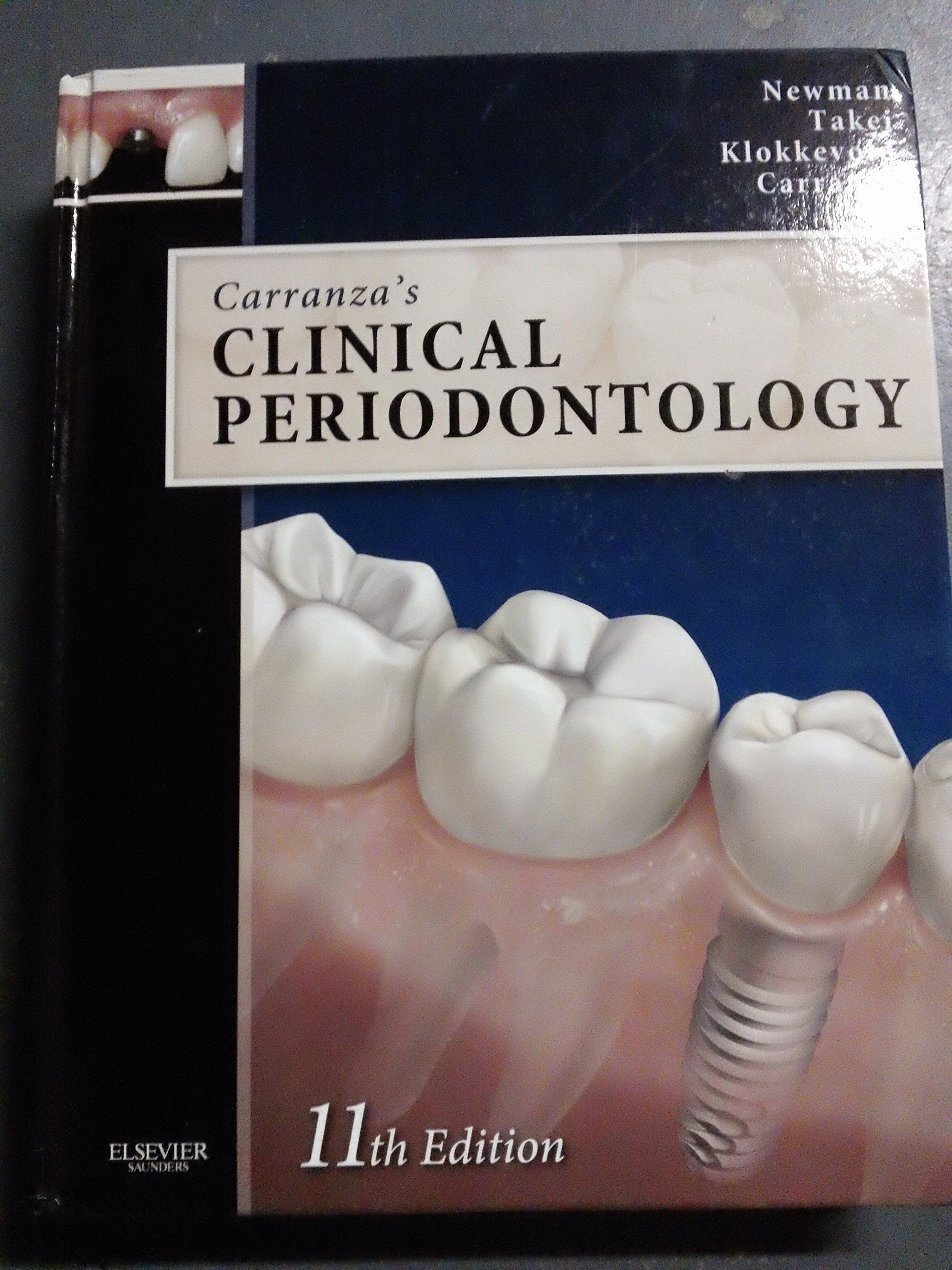Carranza's Clinical Periodontology Expert Consult: Text with Continually Updated Online Reference