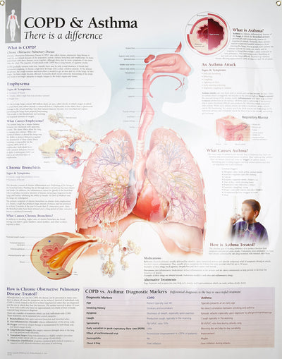 COPD/Asthma chart: Laminated Wall Chart