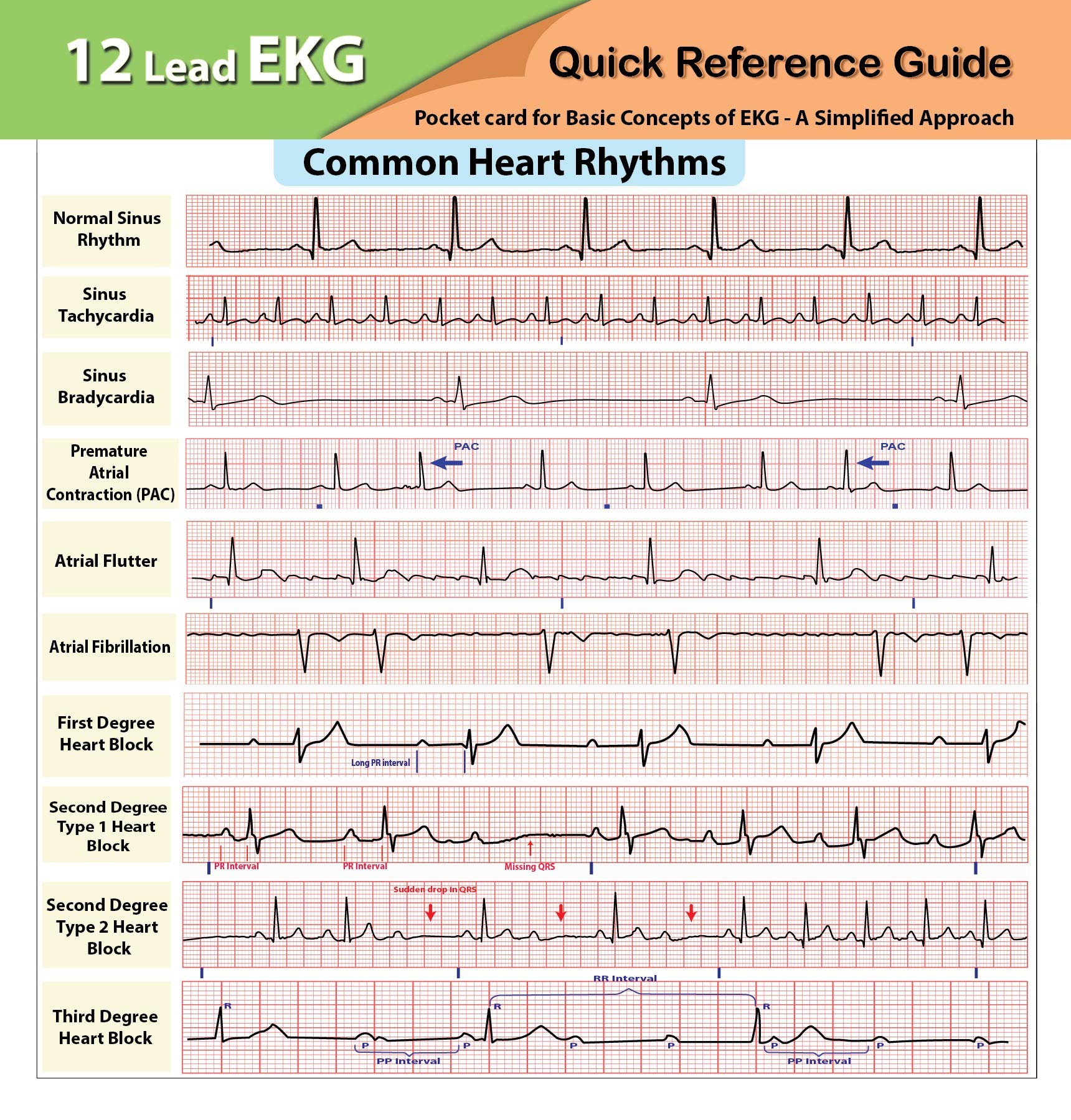12 Lead EKG Pocket Card