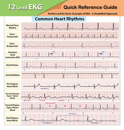 12 Lead EKG Pocket Card
