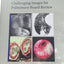 Mayo Clinic Challenging Images for Pulmonary Board Review (Mayo Clinic Scientific Press)