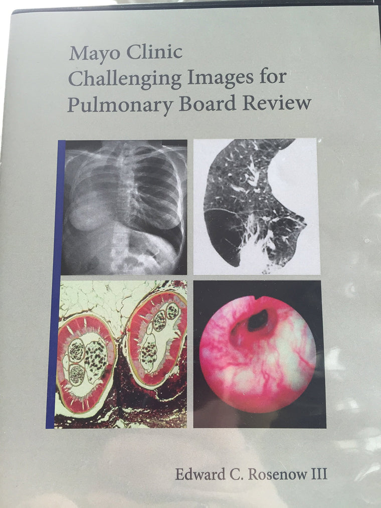 Mayo Clinic Challenging Images for Pulmonary Board Review (Mayo Clinic Scientific Press)
