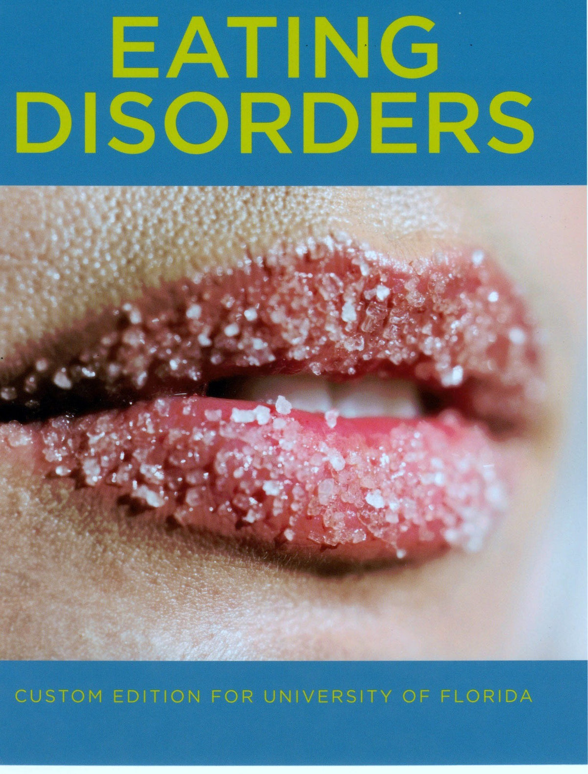 Eating Disorders