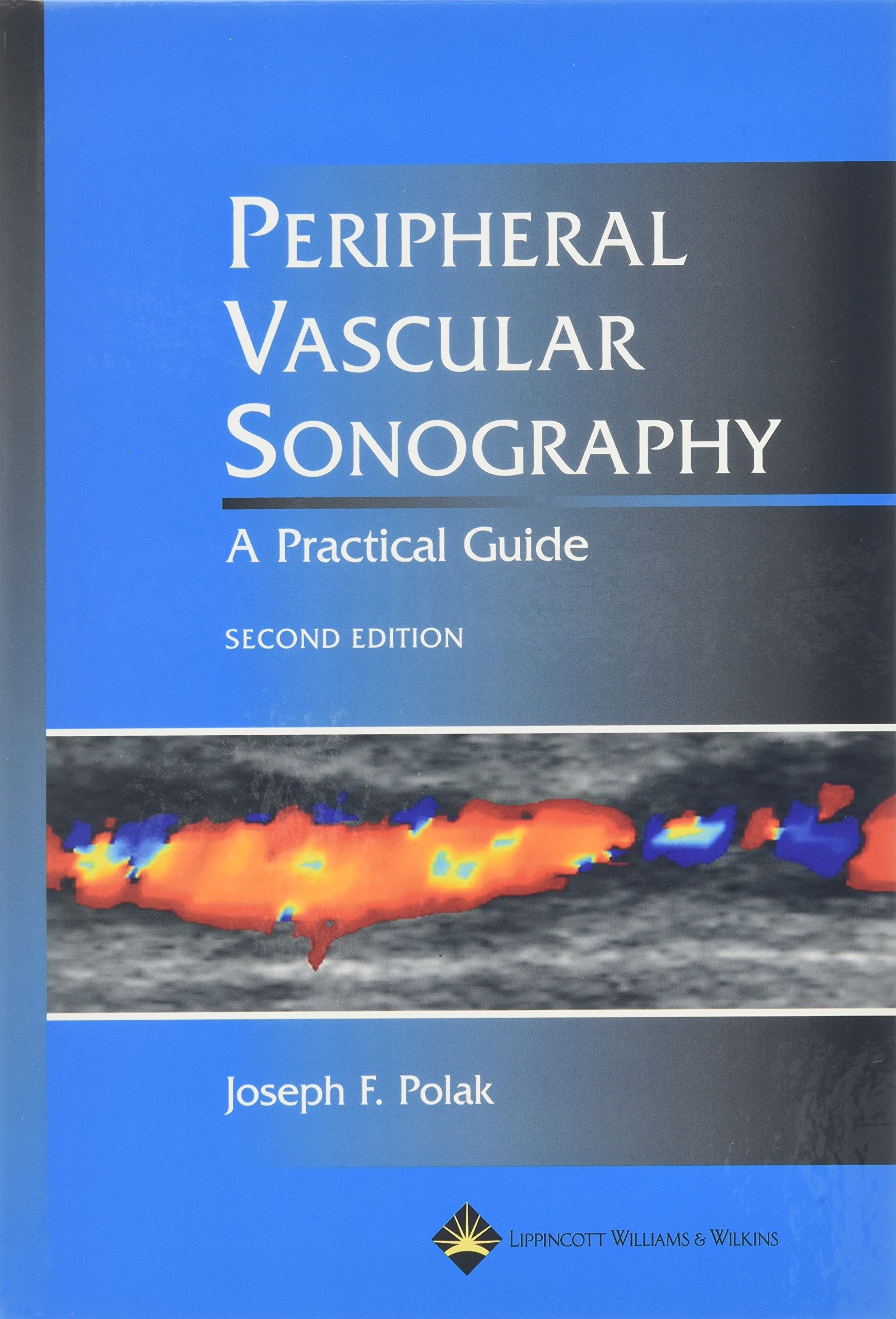 Peripheral Vascular Sonography: A Practical Guide