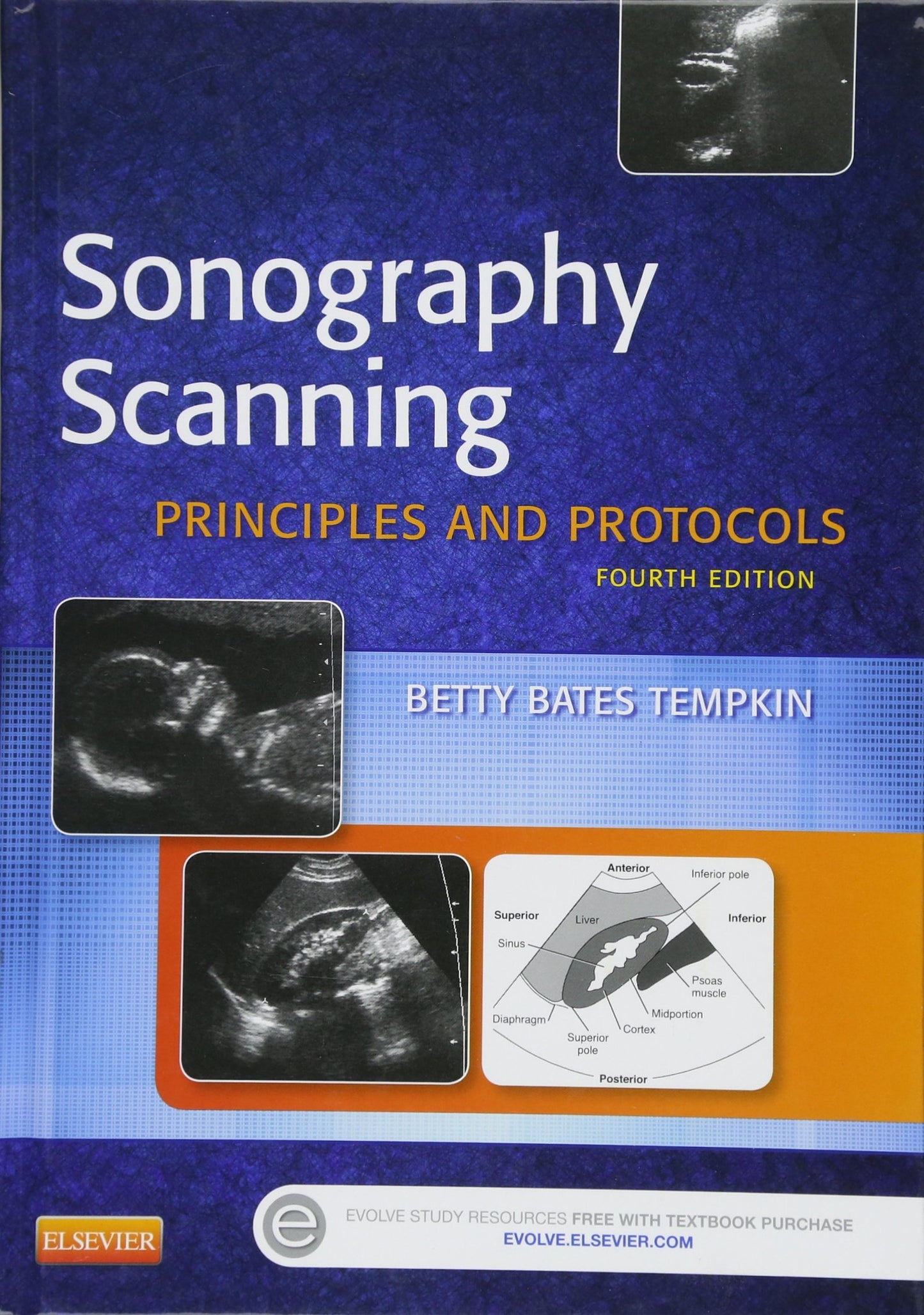 Sonography Scanning: Principles and Protocols (Ultrasound Sc)