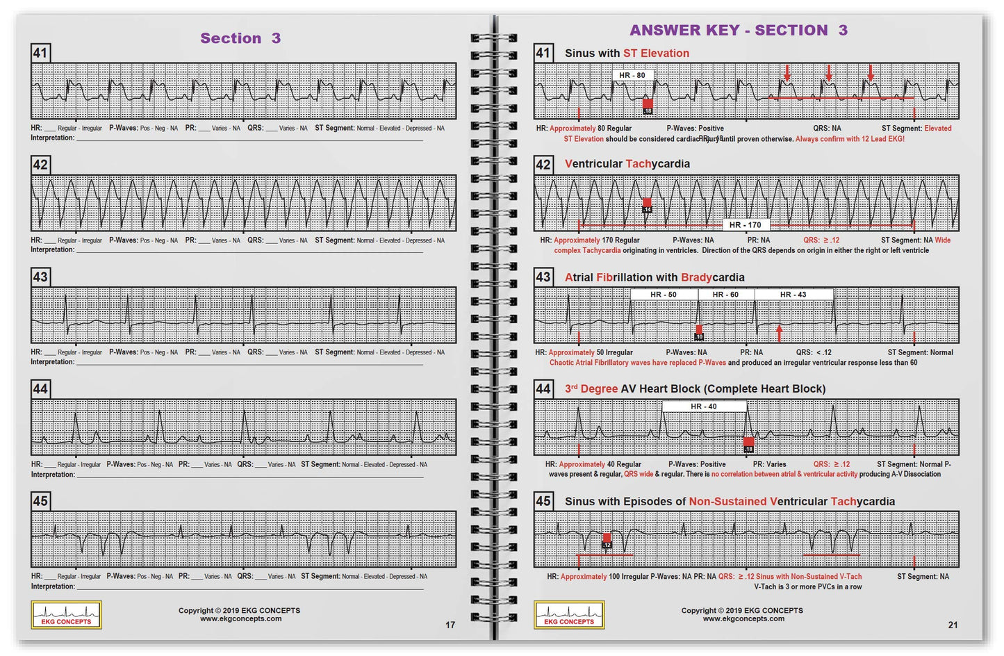 R-CAT EKG Workbook Series 1 - Includes R-CAT EKG Badge