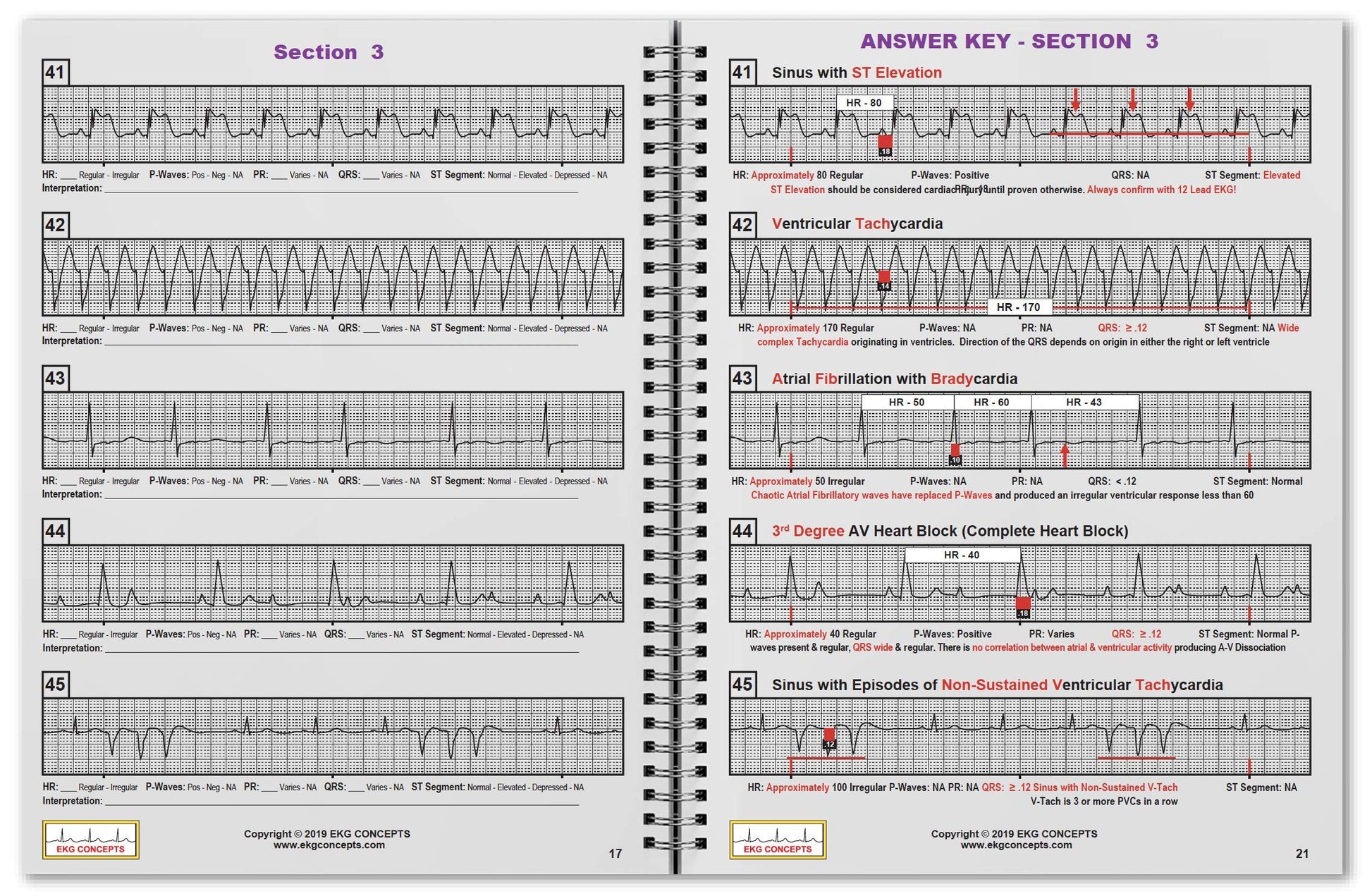 R-CAT EKG Workbook Series 1 - Includes R-CAT EKG Badge