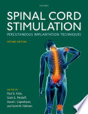 Spinal Cord Stimulation: Percutaneous Implantation Techniques